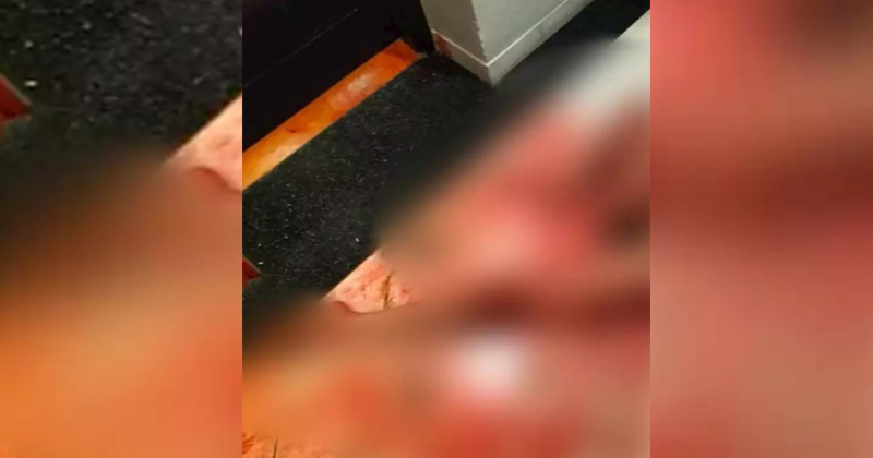 峇厘双裸尸案 女浴血浴缸·男爬出房断气
